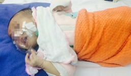 Trẻ nhập viện vì ho gà tăng gấp đôi năm ngoái